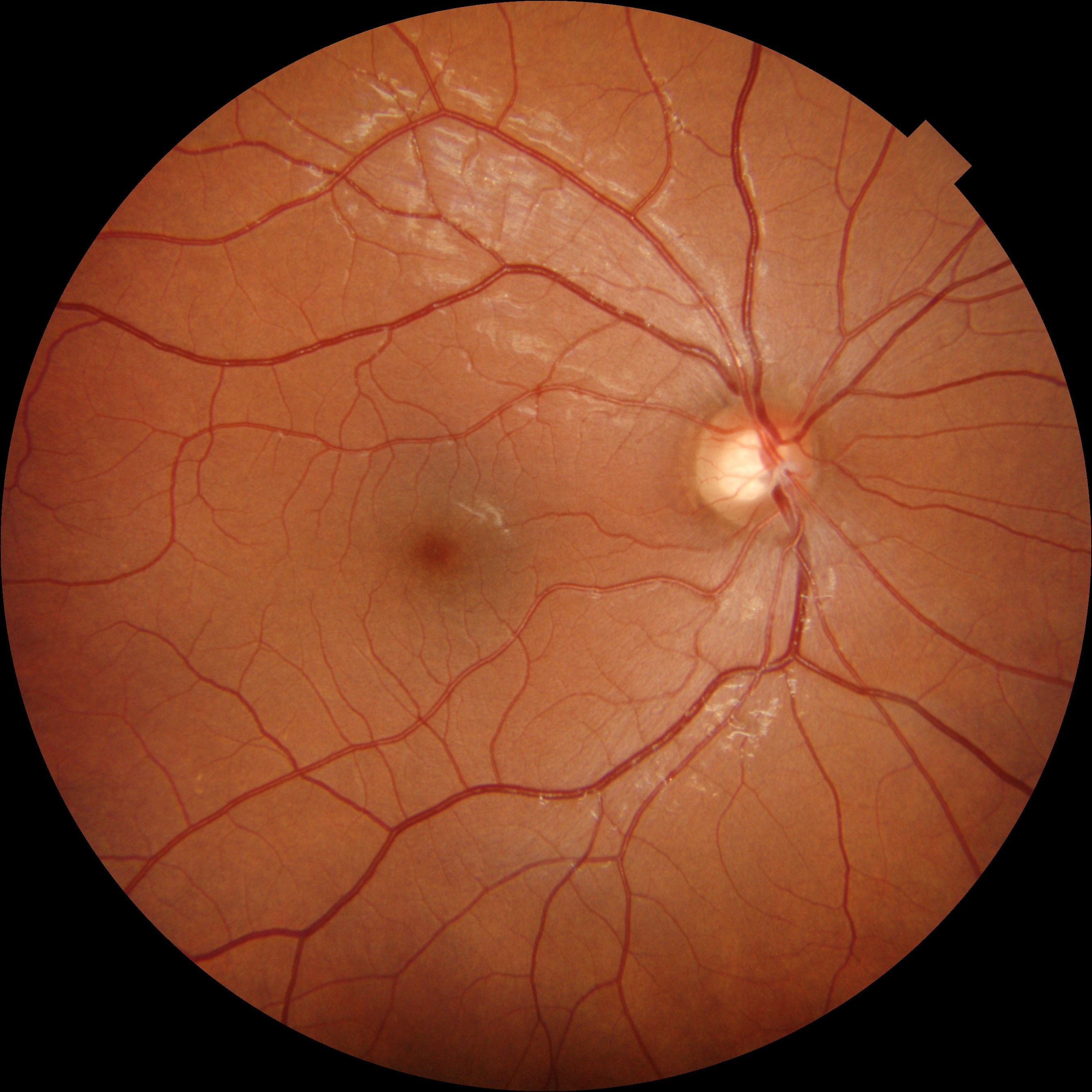 Fundus image
